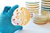4084  Agar Dextrosa Sabouraud con Lecitina y Tween 80 Pqte/10 Placas